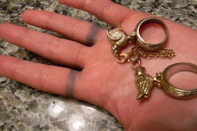 Почему зеленеет кожа от украшений?