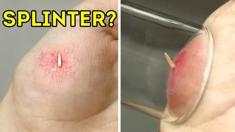 Эти 23 лайфхака пригодятся тем, кто часто получает травмы