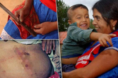 Инес Рамирес: мексиканская крестьянка, сделавшая сама себе кесарево сечение