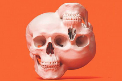 Синдром оборотня и Алисы в Стране чудес: самые необычные синдромы, известные науке