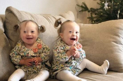 Как близняшки с синдромом Дауна Анетта и Шарлотта очаровали весь мир