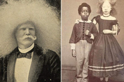 Альбиносы XIX века, попавшие в объектив фотографа