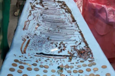 Клад в желудке и зубочистка в сердце: самые странные случаи обращений к врачам